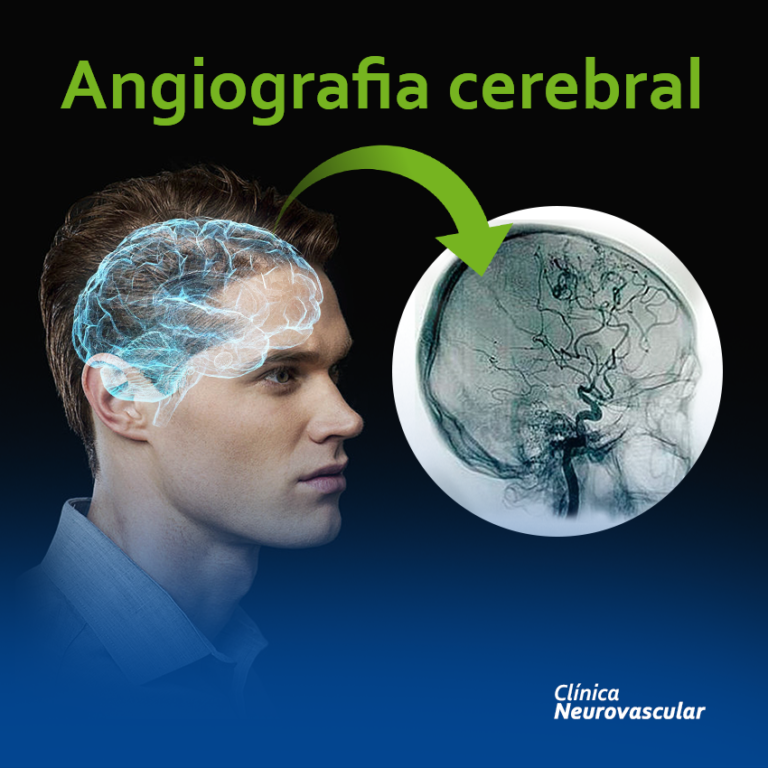 angiografia